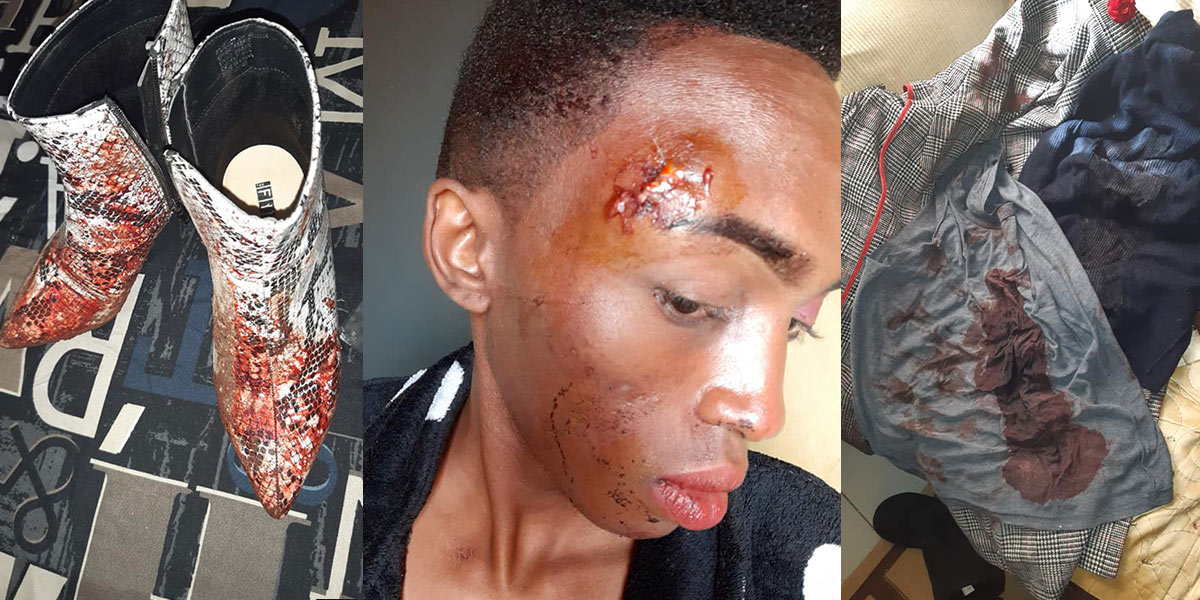 Mpilo Ndlangamandla, a young LGBTQ man, was severely beaten